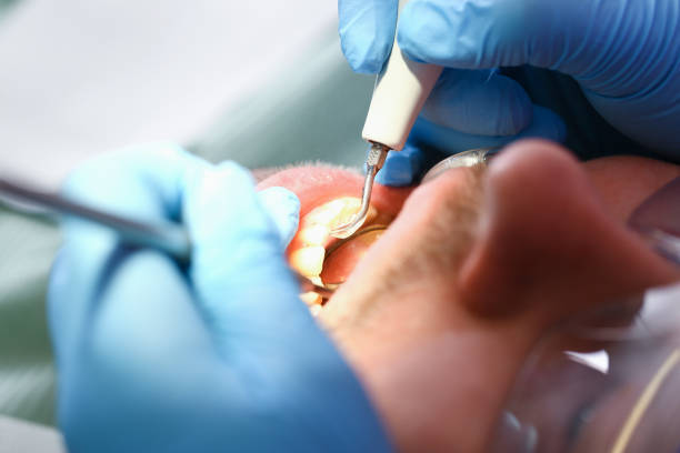 Best Dentist for Tooth Abscess  in Bourbonnais, IL