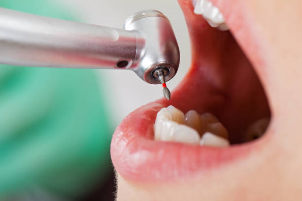 Best Root Canal Emergency Dentist  in Bourbonnais, IL